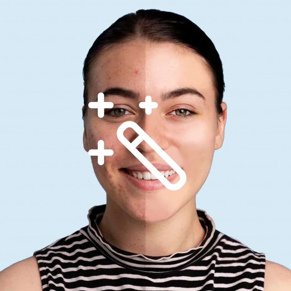 Retouchering